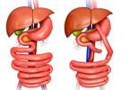 Bariatric Surgery Underused in Adolescents With Severe Obesity Bariatric Surgery Underused in Adolescents With Severe Obesity