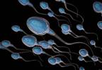 Low Sperm Count Linked to Poor Metabolic, Cardiovascular, Bone Health Low Sperm Count Linked to Poor Metabolic, Cardiovascular, Bone Health