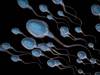 Low Sperm Count Linked to Poor Metabolic, Cardiovascular, Bone Health Low Sperm Count Linked to Poor Metabolic, Cardiovascular, Bone Health