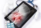 Type 2 Diabetes Associated With Increased Fracture Risk in Postmenopausal Women Type 2 Diabetes Associated With Increased Fracture Risk in Postmenopausal Women