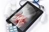 T2D Associated With Increased Fracture Risk in Postmenopausal Women T2D Associated With Increased Fracture Risk in Postmenopausal Women