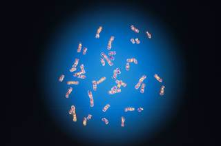 Most luteinizing hormone measurements in early and midchildhood were normal. <i>Photo Credit: GJLP/Science Source.</i> Most luteinizing hormone measurements in early and midchildhood were normal. <i>Photo Credit: GJLP/Science Source.</i>