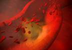 Influence of Gender on Cardiovascular Risk and Glycemic Control in T1D Influence of Gender on Cardiovascular Risk and Glycemic Control in T1D