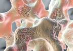 Bone Mineral Density Response Rates With Abaloparatide in Postmenopausal Women Bone Mineral Density Response Rates With Abaloparatide in Postmenopausal Women