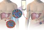 Consensus Report Defines Treatment Success in β-Cell Replacement Therapy Consensus Report Defines Treatment Success in β-Cell Replacement Therapy