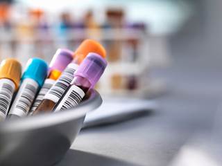 No significant associations between free thyroxine, thyroid-stimulating hormone, and metabolic syndrome were observed. No significant associations between free thyroxine, thyroid-stimulating hormone, and metabolic syndrome were observed.