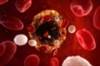 Menopause Symptom Severity May Predict Heart Disease Menopause Symptom Severity May Predict Heart Disease