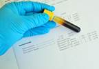 AUA: New Guidelines for Diagnosis, Management of Testosterone Deficiency AUA: New Guidelines for Diagnosis, Management of Testosterone Deficiency