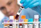 Soluble Klotho Levels Predictive of Kidney Failure in Type 2 Diabetes Soluble Klotho Levels Predictive of Kidney Failure in Type 2 Diabetes