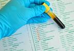 Metabolic Syndrome Associated With Higher ALT Levels in Chronic Hepatitis B Metabolic Syndrome Associated With Higher ALT Levels in Chronic Hepatitis B