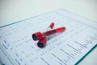 A one-standard-deviation increase in log-aldosterone was associated with a 44% higher risk of incident diabetes. A one-standard-deviation increase in log-aldosterone was associated with a 44% higher risk of incident diabetes.