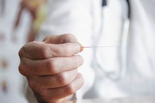 Patients will be randomly assigned to needle acupuncture, verum laser acupuncture, and placebo laser acupuncture. Patients will be randomly assigned to needle acupuncture, verum laser acupuncture, and placebo laser acupuncture.