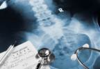 Type 2 Diabetes Linked With Higher Risk for Hip Fractures Type 2 Diabetes Linked With Higher Risk for Hip Fractures