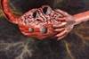 Serum Chemerin May Predict Risk for Spontaneous Abortion in Women With PCOS Serum Chemerin May Predict Risk for Spontaneous Abortion in Women With PCOS