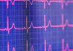 Heart Rate Variability in Type 2 Diabetes Heart Rate Variability in Type 2 Diabetes