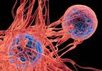 Cancer Development Linked to Increased Diabetes Risk Cancer Development Linked to Increased Diabetes Risk