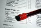 Sex Hormone Levels May Affect Postmenopausal Heart Disease Risk Sex Hormone Levels May Affect Postmenopausal Heart Disease Risk