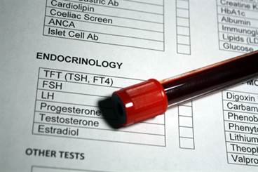 Sex Hormone Levels May Affect Postmenopausal Heart Disease Risk Sex Hormone Levels May Affect Postmenopausal Heart Disease Risk