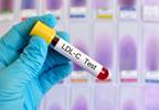 Empagliflozin Reduces Risk for Nephropathy Regardless of Blood Pressure, LDL Cholesterol, HbA1c Empagliflozin Reduces Risk for Nephropathy Regardless of Blood Pressure, LDL Cholesterol, HbA1c