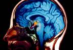 Guidelines for Management of Hypothalamic-Pituitary, Growth Disorders in Childhood Cancer Survivors Guidelines for Management of Hypothalamic-Pituitary, Growth Disorders in Childhood Cancer Survivors