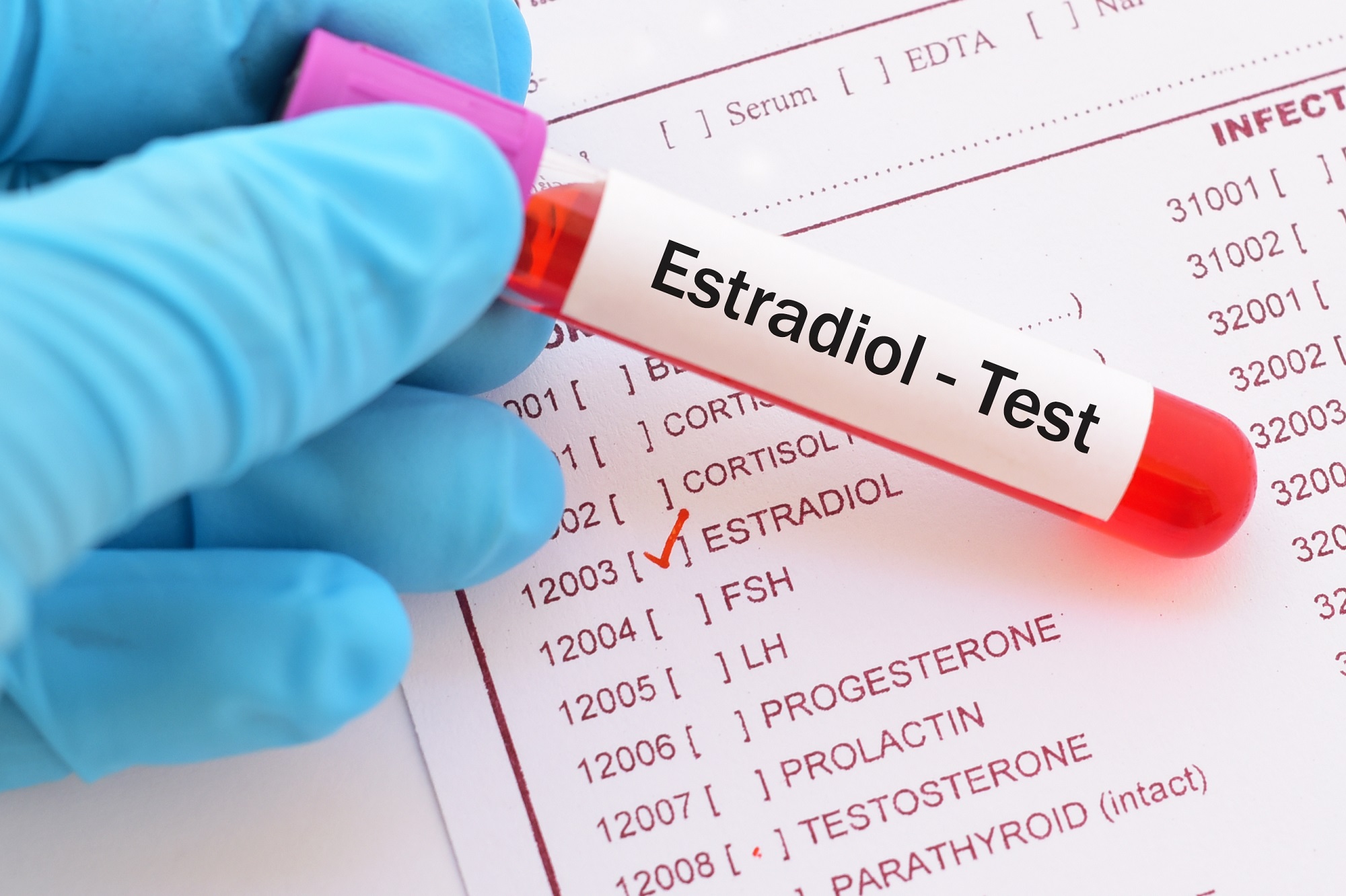 What Is The Normal Range For Estradiol Levels In Men