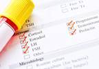 Adjunctive Aripiprazole Lowers Prolactin Levels in Women With Psychosis Adjunctive Aripiprazole Lowers Prolactin Levels in Women With Psychosis