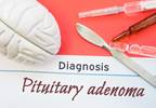 Conservative Monitoring Strategy for Non-Functioning Pituitary Adenomas Evaluated Conservative Monitoring Strategy for Non-Functioning Pituitary Adenomas Evaluated