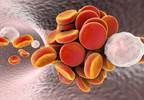 Cross-Sex Hormone Therapy May Raise Vascular Event Risk in Transgender Persons Cross-Sex Hormone Therapy May Raise Vascular Event Risk in Transgender Persons