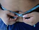 Body Muscle-to-Fat Ratio as a Sleep Apnea Screening Tool in Type 2 Diabetes Body Muscle-to-Fat Ratio as a Sleep Apnea Screening Tool in Type 2 Diabetes
