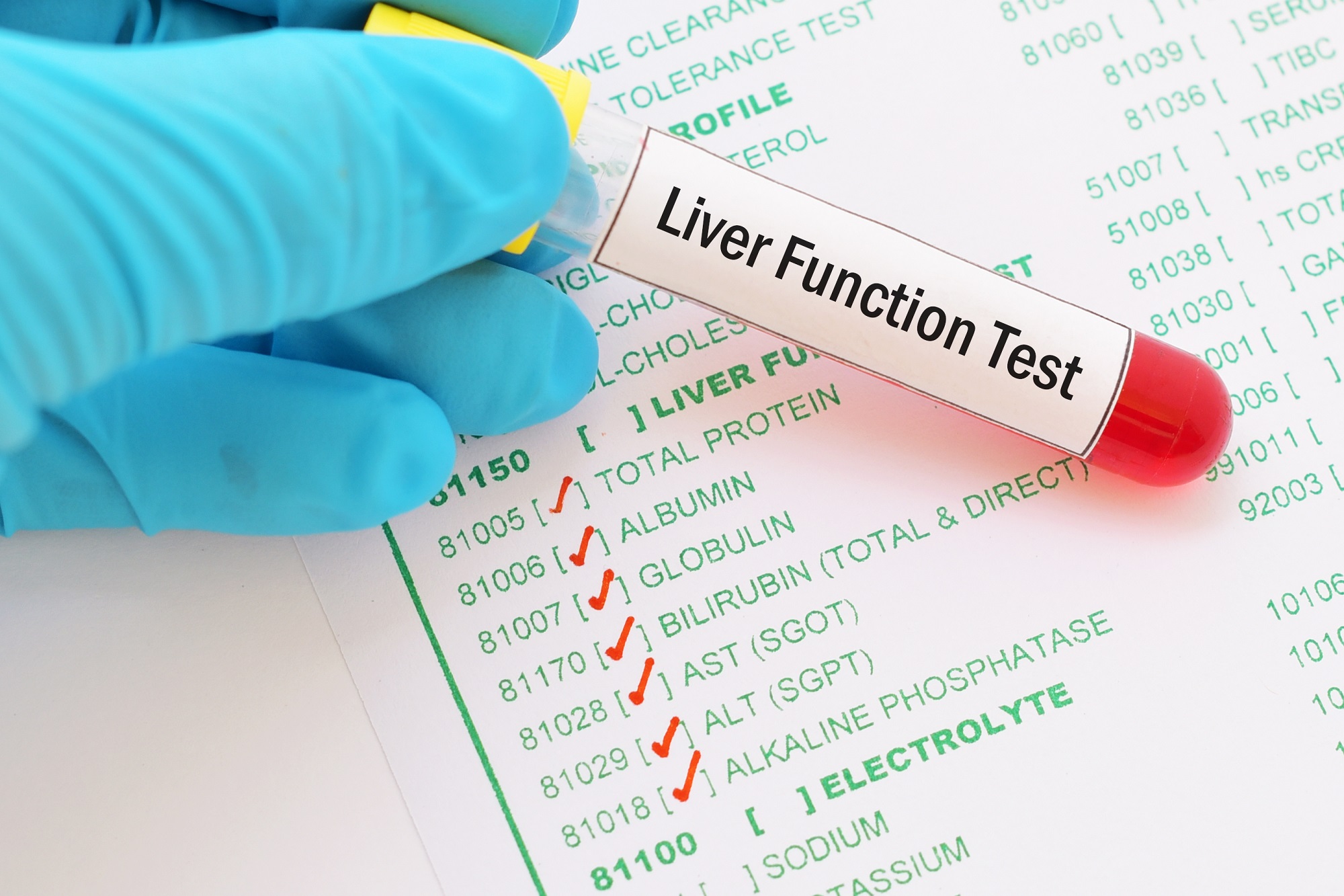 What Is A Hepatic Function Panel Test For