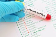 Hepatic Markers Linked To Early Predictors Of Type 2 Diabetes Risk In 