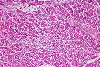 Extracellular volume was significantly larger in patients with HbA1c between 6.5% and 7.5% and HbA1c >7.5% than those with HbA1c <6.5%. <i>Credit: Carolina Biological</i> Extracellular volume was significantly larger in patients with HbA1c between 6.5% and 7.5% and HbA1c >7.5% than those with HbA1c <6.5%. <i>Credit: Carolina Biological</i>