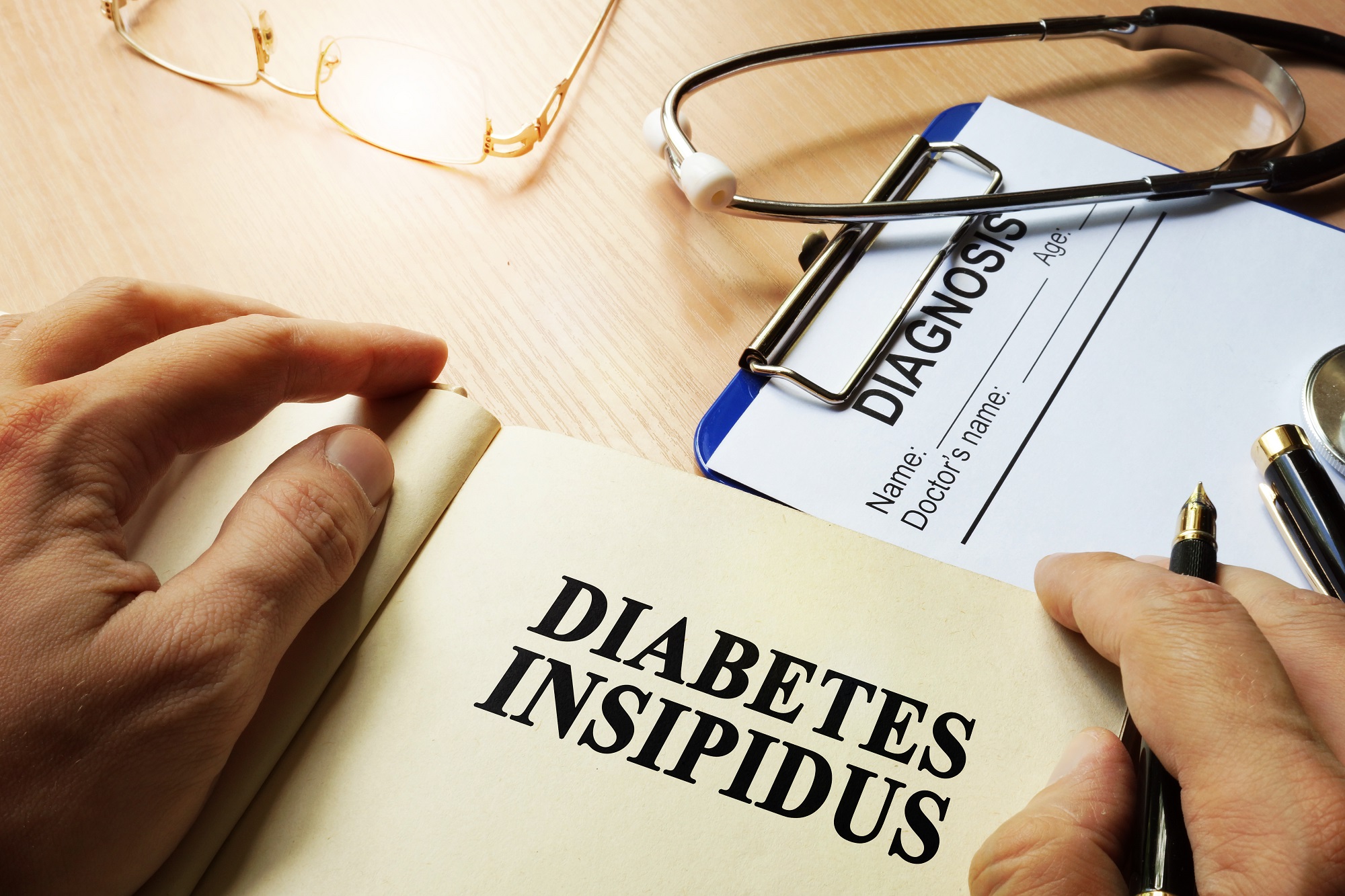 Diabetes Insipidus Causes Symptoms And Treatment