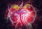 Nonfunctioning Adrenal Incidentaloma Associated With Metabolic Syndrome Nonfunctioning Adrenal Incidentaloma Associated With Metabolic Syndrome