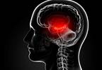 Vascular Risk Factors for Brain Calcification in Seniors Identified Vascular Risk Factors for Brain Calcification in Seniors Identified