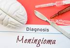 Higher Risk for Meningioma Linked to GH Treatment, Radiotherapy During Childhood Higher Risk for Meningioma Linked to GH Treatment, Radiotherapy During Childhood