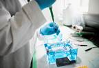 Genetics May Identify Type 2 Diabetes Subtypes Genetics May Identify Type 2 Diabetes Subtypes