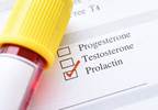 High Levels of Prolactin in Women Inversely Linked to T2D Risk High Levels of Prolactin in Women Inversely Linked to T2D Risk