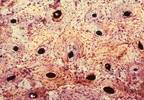 Bone-Derived Factors in the Treatment of Diabetes Bone-Derived Factors in the Treatment of Diabetes