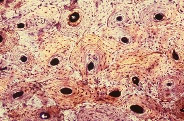 Bone-Derived Factors in the Treatment of Diabetes Bone-Derived Factors in the Treatment of Diabetes