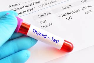 While subclinical hypothyroidism is common in the general population, clinical practice guidelines vary in recommendations for managing the condition. While subclinical hypothyroidism is common in the general population, clinical practice guidelines vary in recommendations for managing the condition.