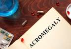 Early Manifestations, Sex Differences May Aid in Acromegaly Diagnosis Early Manifestations, Sex Differences May Aid in Acromegaly Diagnosis