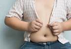 Pediatric Obesity Linked to Slipped Capital Femoral Epiphysis Pediatric Obesity Linked to Slipped Capital Femoral Epiphysis