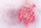 Risk for T2D Increases Following Total or Partial Colectomy Risk for T2D Increases Following Total or Partial Colectomy