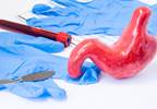 Safety and Effectiveness of the Most Common Bariatric Procedures Examined Safety and Effectiveness of the Most Common Bariatric Procedures Examined