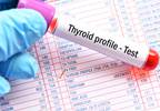 High Free T4 Levels Within Reference Range Associated With Atrial Fibrillation High Free T4 Levels Within Reference Range Associated With Atrial Fibrillation