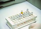 Common Interferences in Thyroid Immunoassays Common Interferences in Thyroid Immunoassays