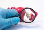 Genome-Wide PCOS Studies Suggest Correlations With Metabolic, Neuroendocrine Pathways Genome-Wide PCOS Studies Suggest Correlations With Metabolic, Neuroendocrine Pathways